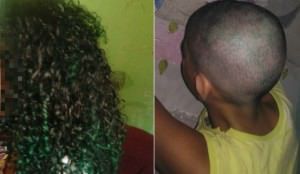A adolescente antes e após ter o cabelo raspado pelo pai em Jacaraípe. Foto: Arquivo da família