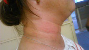 A agressão aconteceu no Cmei Olinda Rosa Silva, em Nova Carapina I. Foto: Divulgação leitor