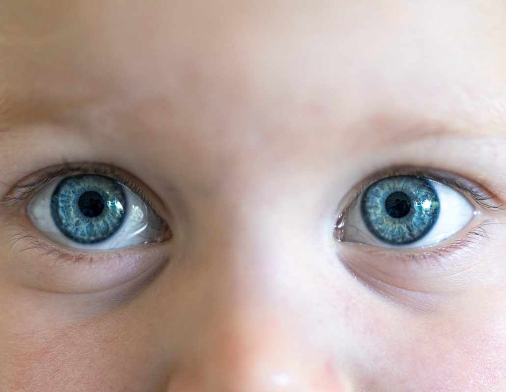 Retinoblastoma, um câncer raro que pode ocorrer nos olhos das crianças -  Blog Saúde Infantil