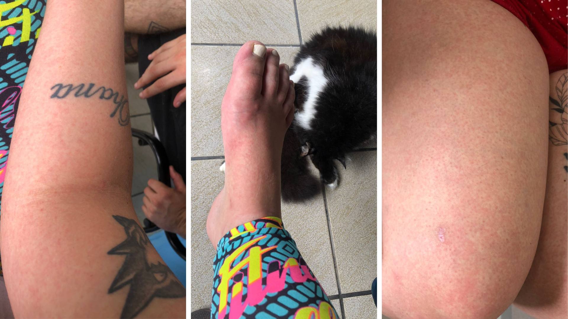 3 fotos dengue Serra