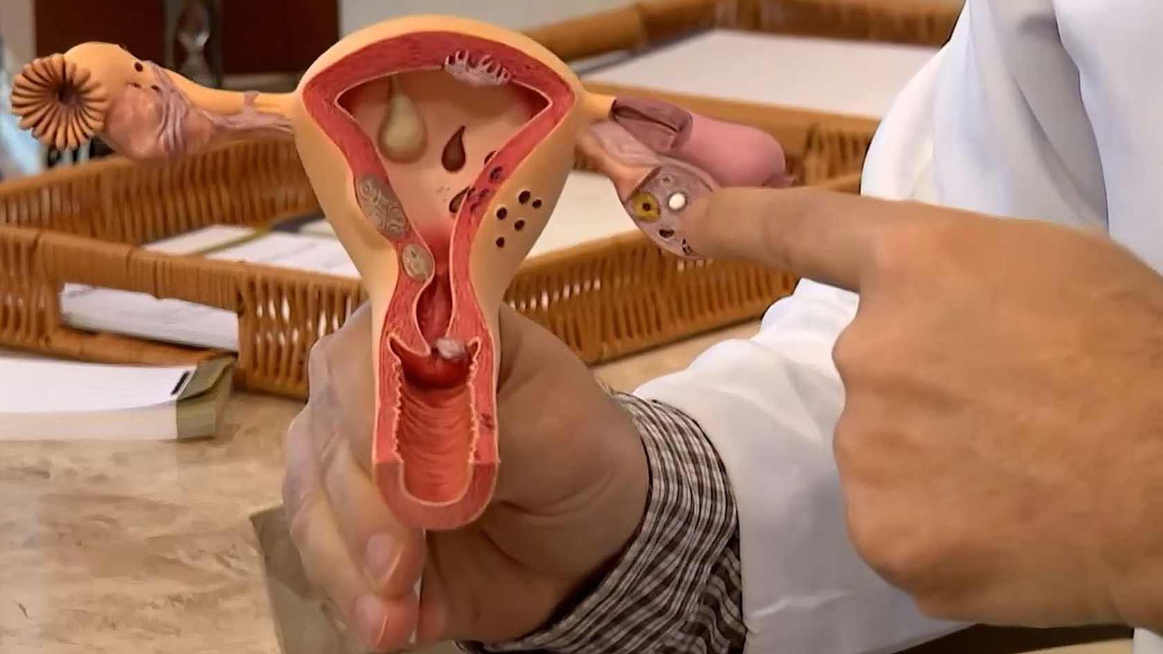 Câncer ginecológico