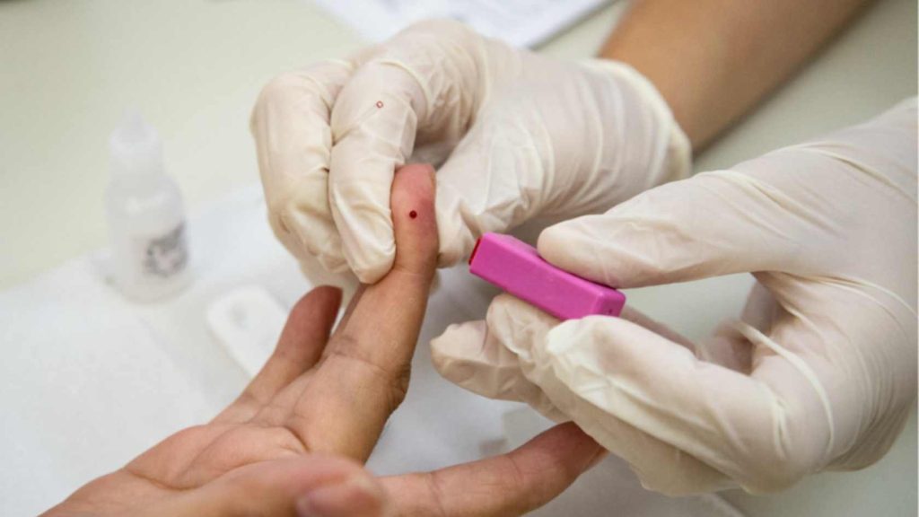 HIV/Aids