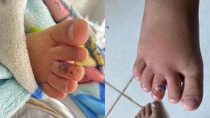 Criança Cobra Escola Serra