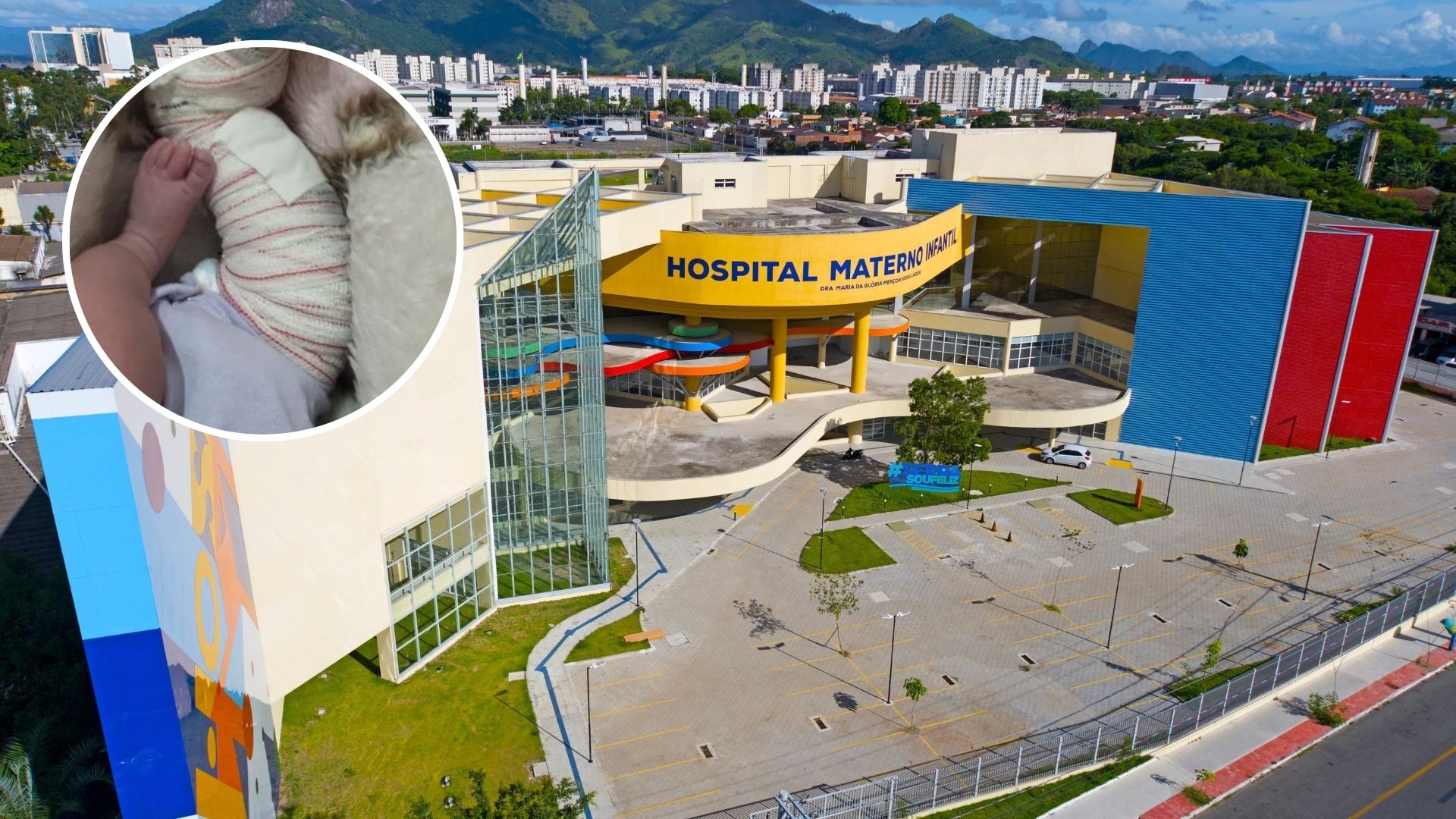Hospital Materno Infantil Serra Bebê Perna quebrada