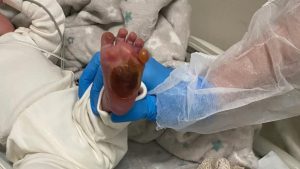 Técnica de Enfermagem Serra Hospital Bebê