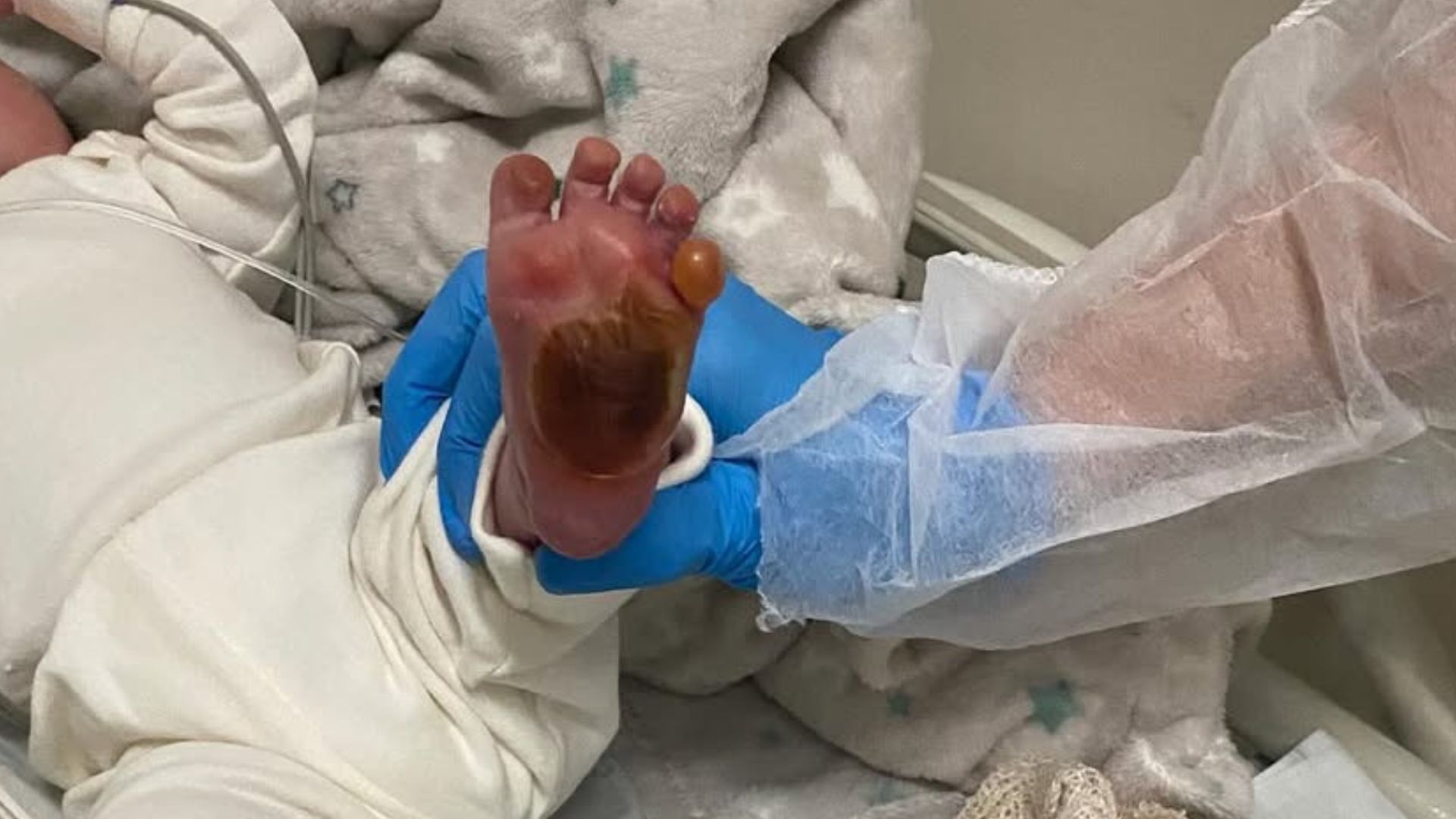 Técnica de Enfermagem Serra Hospital Bebê